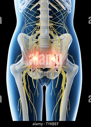 3d rendered illustration of the sciatic nerve Stock Photo - Alamy