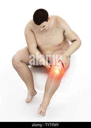 3d rendered medically accurate illustration of an obese mans painful knee Stock Photo