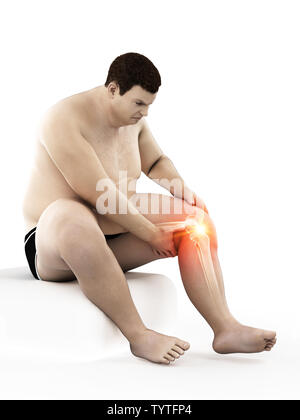 3d rendered medically accurate illustration of an obese mans painful knee Stock Photo