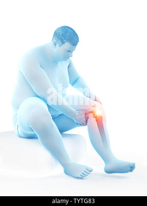 3d rendered medically accurate illustration of an obese mans painful knee Stock Photo