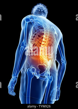 Human back pain, illustration Stock Photo - Alamy