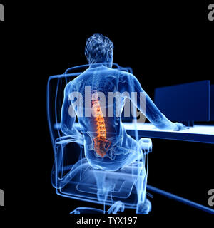 3d rendered medically accurate illustration of an office worker having a painful back Stock Photo