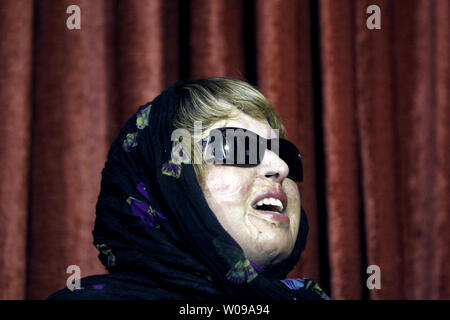 Ameneh Bahrami attends  a meeting in Tehran,Iran on Aug 8,2011. Ameneh was blinded and disfigured by her suitor, who throws acid on to her face after she turned down his marriage proposal in 2004. After that she spent many years between Iran and Spain undergoing numerous operations to reconstruct her face and repair her sight.      UPI/Maryam Rahmanian Stock Photo
