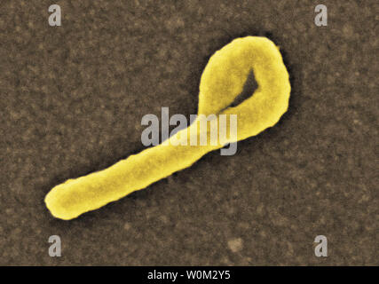 This National Institute of Allergy and Infectious Diseases (NIAID) image taken on August 12, 2014 by a digitally-colorized scanning electron micrograph (SEM) depicts a single filamentous Ebola virus particle. Ebola hemorrhagic fever (Ebola HF) is one of numerous Viral Hemorrhagic Fevers. It is a severe, often fatal disease in humans and nonhuman primates. UPI/NIAID Stock Photo