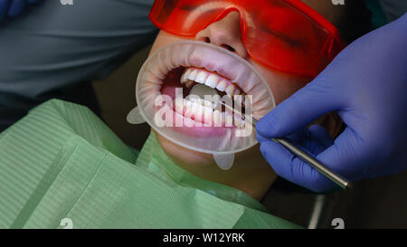 Dentist examines condition of back surface of teeth with help of dental mirror in girl patient. Primary reception. Dental clinic. Health care. Stock Photo