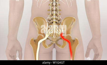 Sciatic Pinched Nerve Pain 3D Illustration Stock Photo