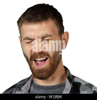 Man with real eye bruise Stock Photo