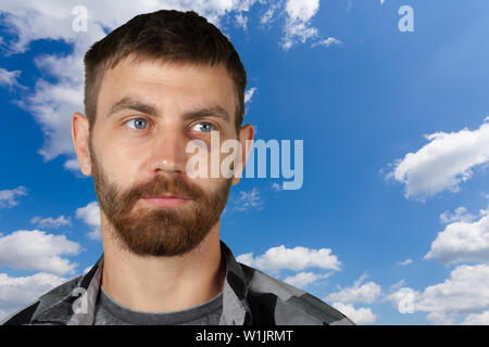 Man with real eye bruise Stock Photo