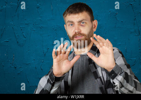 Man with real eye bruise Stock Photo