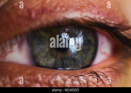 open human eye with bright red arteries close up. irritation and redness of the eyeball. pupils, iris, eyelashes in macro. vision problems. Stock Photo