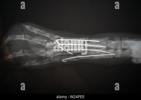 Radiography of a dog paw. Real x ray image of an injured dog paw . Stock Photo