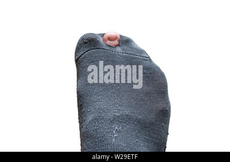 Worn out sock with a hole and toe sticking out of it on white background  Stock Photo - Alamy