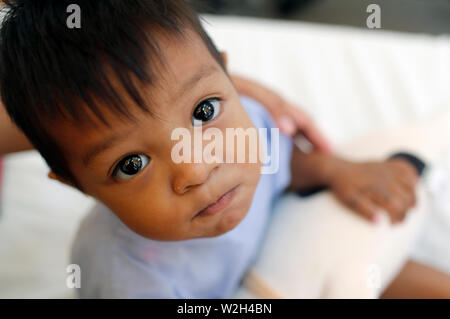 Calmette Hospital. Cardiac surgery ward.  Young boy.  Phnom Penh. Cambodia. Stock Photo