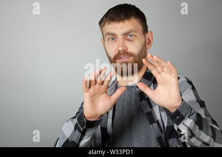 Man with real eye bruise Stock Photo