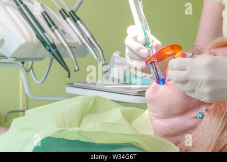 Close up view of dentist's hands use blue LED dental curing light to fix a filling. Stock Photo