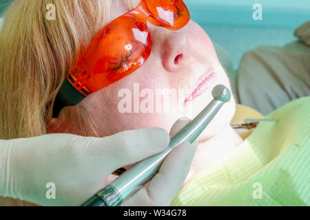 The most common method to remove the tooth decay in and around the cavities was drilling it out and catching the decay as early as possible. Stock Photo