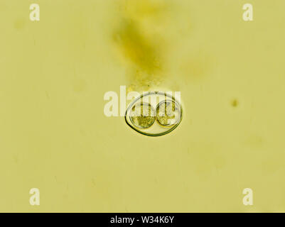 Isospora spp. oocyst from cat feces under the microscope Stock Photo