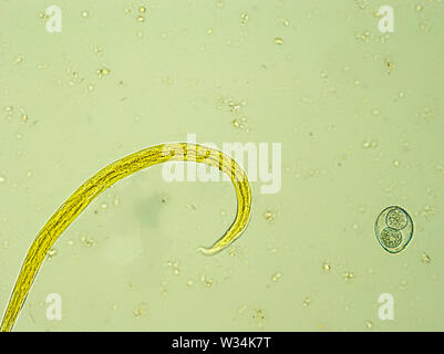 Aelurostrongylus abstrusus larva and Isospora spp. oocyst under the microscope Stock Photo