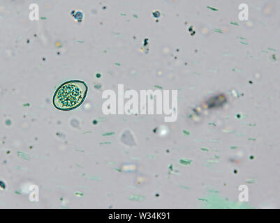 Isospora spp. oocyst from cat feces under the microscope Stock Photo