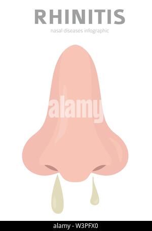 Nasal diseases. Rhinitis symptoms, treatment icon set. Medical ...