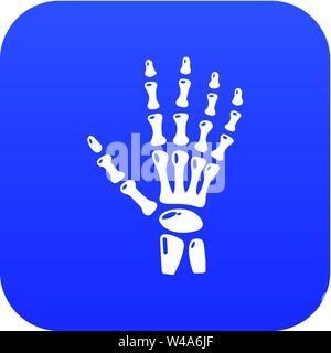 Inflammation of hand icon, simple style. Stock Vector