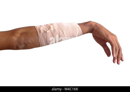 arm accident with wound health body with clipping path on white background Stock Photo
