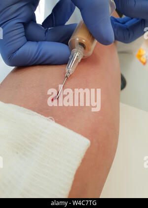 The doctor takes blood from the cubital vein Stock Photo