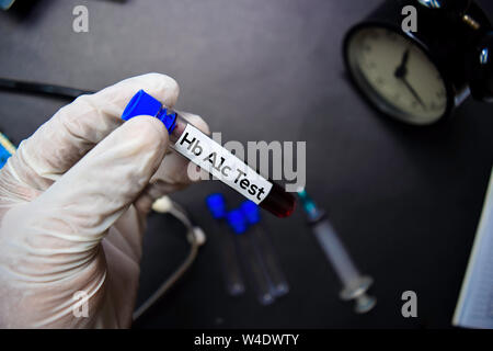 Hb A1c Test text with blood sample. Top view isolated on black background. Healthcare/Medical concept Stock Photo