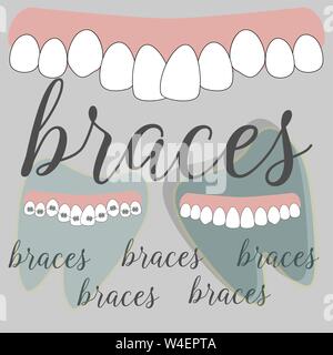 Braces dentistry in beautiful style. Vector flat design illustration Stock Vector