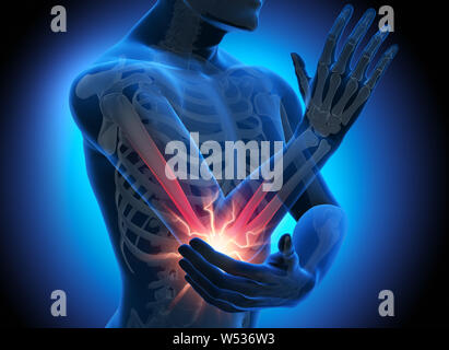 Man with strong pain in ellbow joint - 3D illustration Stock Photo