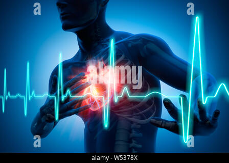 Man with heart attack and chest pain - 3D illustration Stock Photo
