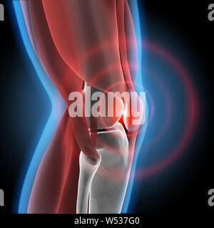 Strong pain in knee joint - 3D illustration Stock Photo