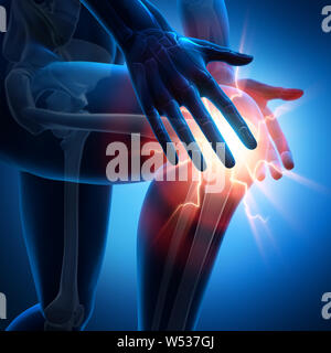 Strong pain in knee joint - 3D illustration Stock Photo