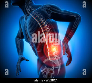Strong pain in spine - 3D illustration Stock Photo