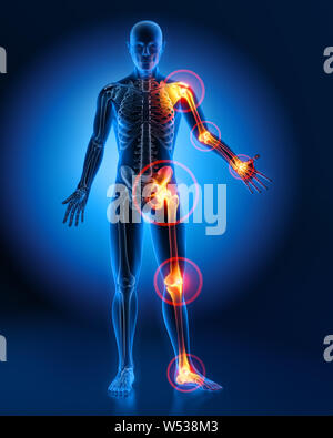 Man Male body with painful joints - 3D Illustration Stock Photo