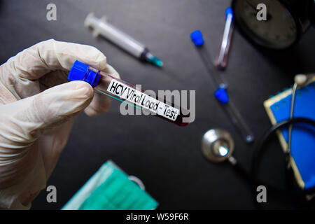 Blood sample for hepatitis B virus (HBV) testingl on request form Stock ...