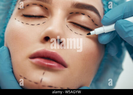 Becoming perfect. Close up photo of young woman with glowing skin in blue medical hat waiting for facial surgery while plastic surgeon in blue gloves drawing dashed line under eyes. Beauty concept. Facelift. Plastic surgery Stock Photo