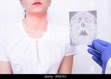 Doctor specialist holds X-ray picture on the background of a young girl who has tonsillitis of the throat and nasopharynx, inflammation of the lymph n Stock Photo