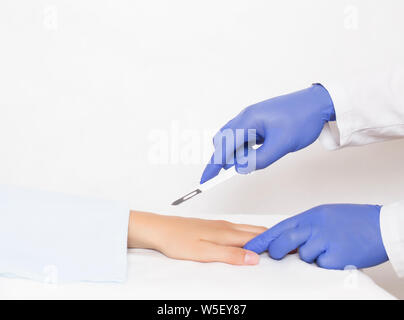 dotcore surgeon holds a scalpel near the radiocarpal joint on the girl s arm, the concept of operation and treatment of carpal tunnel syndrome and joi Stock Photo