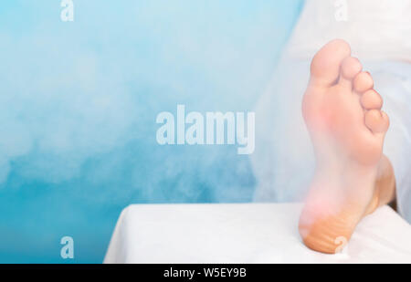 Treatment of warts on the sole of the foot and corns with liquid nitrogen and cryotherapy, plantar wart and corns Stock Photo