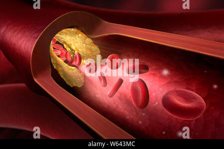 Red blood cells - narrowing inside a blood vessel - Erythrocyte 3D illustration Stock Photo