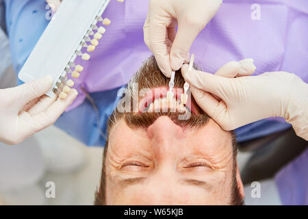 Patient with professional teeth whitening when comparing the tooth color with the dentist Stock Photo