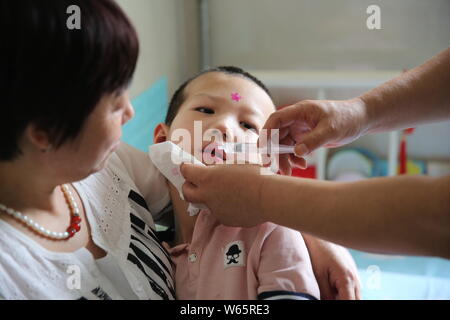 Chinese care worker Zhang Xia looks after the 7-year-old boy Peng Peng who was seriously injured due to his stepmother's cruel treatment at a hospital Stock Photo