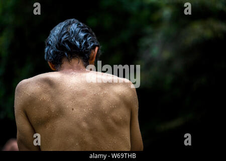Detail of the wet back of a swimmer sitting on a rock at the bank of a river in the temperate land of the Andean mountains of central Colombia. Stock Photo