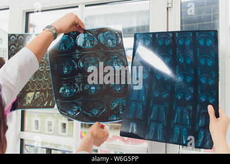 Professional medical team examining patient's medical records and x-ray. brain x-ray. Stock Photo
