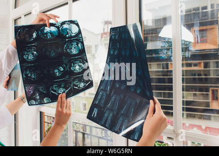 Professional medical team examining patient's medical records and x-ray. brain x-ray. Stock Photo