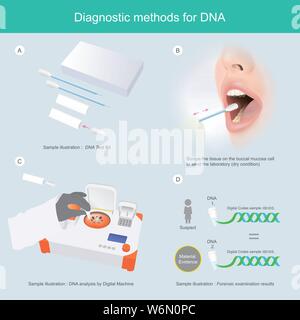 Sample picture Illustrate explain DNA detection procedure used scrape the tissue on the buccal mucosa cell to send the lab. Illustration infographic. Stock Vector