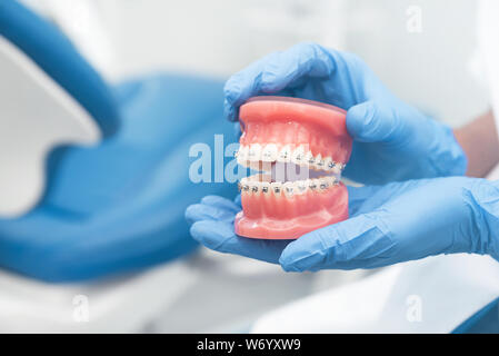 Dentist holding jaw model. Dentistry, dental care, healthy teeth, orthodontics concept Stock Photo