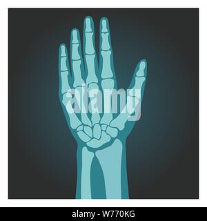 X-ray shot of wrist, human body, bones of hand, radiography, vector illustration. Stock Vector