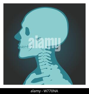X-ray shot of skull, human body, head and neck bones side view, radiography, vector illustration. Stock Vector